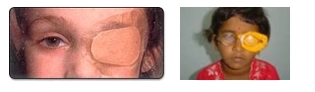 image1 image1