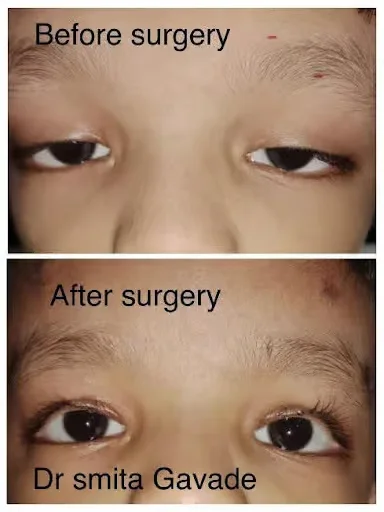 image5 image5