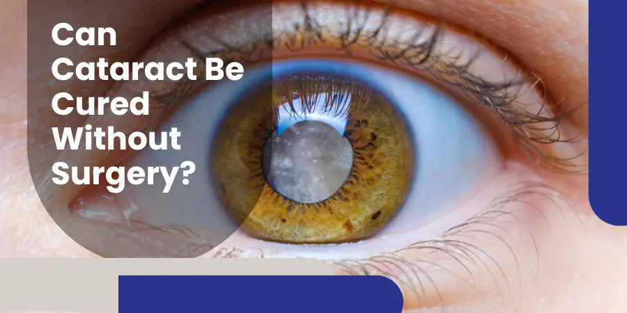 Can Cataract Be Cured Without Surgery- featured image