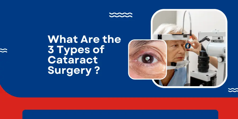 What Are the 3 Types of Cataract Surgery