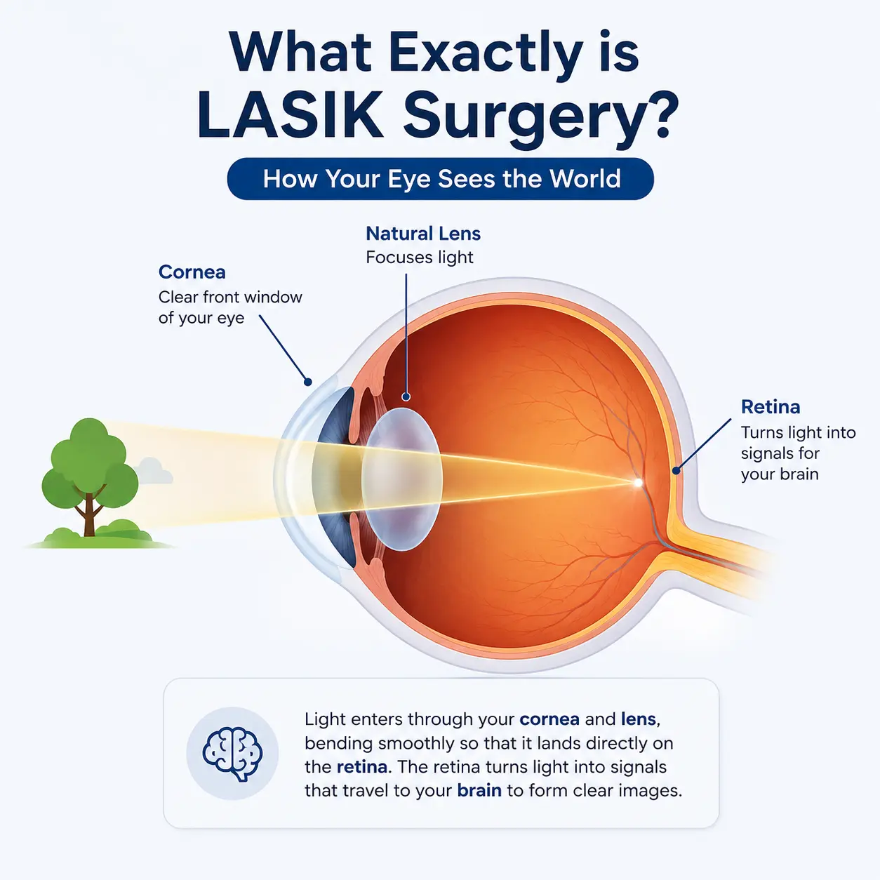 LASIK surgery eye anatomy diagram